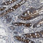 ABHD15 Antibody in Immunohistochemistry (Paraffin) (IHC (P))