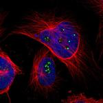 TMEM143 Polyclonal Antibody
