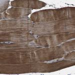 TMEM143 Antibody in Immunohistochemistry (Paraffin) (IHC (P))