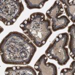 TMEM143 Antibody in Immunohistochemistry (Paraffin) (IHC (P))