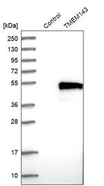 TMEM143 Antibody in Western Blot (WB)