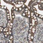 CLRN3 Antibody in Immunohistochemistry (Paraffin) (IHC (P))