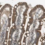 CLRN3 Polyclonal Antibody