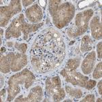 CLRN3 Antibody in Immunohistochemistry (Paraffin) (IHC (P))