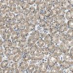 ZDHHC20 Polyclonal Antibody