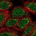 TMEM223 Polyclonal Antibody