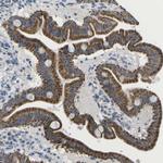TMEM223 Antibody in Immunohistochemistry (Paraffin) (IHC (P))