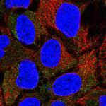 CLCN2 Polyclonal Antibody