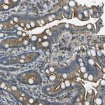 LRRC66 Polyclonal Antibody