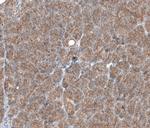 TMEM30A Polyclonal Antibody