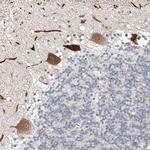 STARD9 Polyclonal Antibody