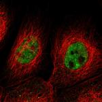 KIAA0355 Antibody in Immunocytochemistry (ICC/IF)