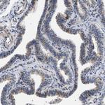 KIAA0355 Antibody in Immunohistochemistry (Paraffin) (IHC (P))