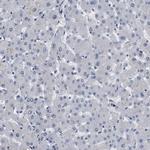 KIAA0355 Antibody in Immunohistochemistry (Paraffin) (IHC (P))