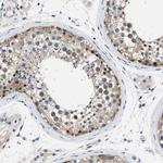 KIAA0355 Antibody in Immunohistochemistry (Paraffin) (IHC (P))