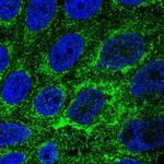 TMEM141 Polyclonal Antibody