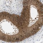 GMPPB Polyclonal Antibody