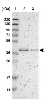 GMPPB Antibody in Western Blot (WB)