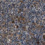 ARHGEF11 Antibody in Immunohistochemistry (IHC)