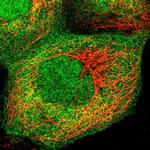 UAP1 Polyclonal Antibody