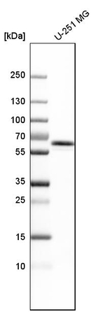UAP1 Antibody in Western Blot (WB)