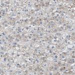 UAP1 Antibody in Immunohistochemistry (IHC)