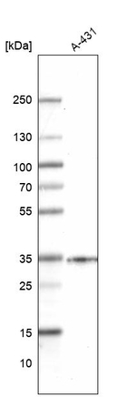 SLC25A22 Antibody in Western Blot (WB)