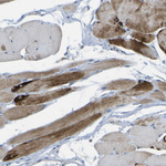 DPM3 Antibody in Immunohistochemistry (Paraffin) (IHC (P))