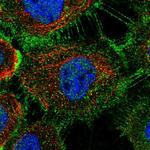 ZDHHC5 Polyclonal Antibody