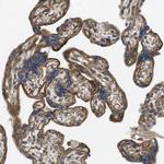 ZDHHC5 Antibody in Immunohistochemistry (IHC)