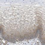 ZDHHC5 Antibody in Immunohistochemistry (IHC)