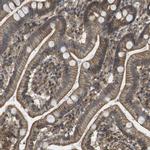ZDHHC5 Antibody in Immunohistochemistry (IHC)