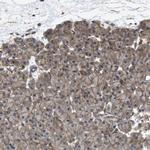 ZDHHC5 Antibody in Immunohistochemistry (IHC)
