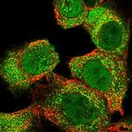 SLC22A23 Polyclonal Antibody