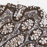 SLC22A23 Antibody in Immunohistochemistry (Paraffin) (IHC (P))