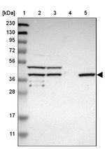SLC22A23 Antibody in Western Blot (WB)