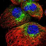 SCAMP2 Polyclonal Antibody