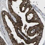 SCAMP2 Antibody in Immunohistochemistry (Paraffin) (IHC (P))