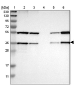 SCAMP2 Antibody in Western Blot (WB)