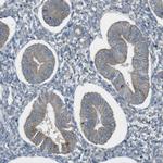 ZDHHC20 Polyclonal Antibody