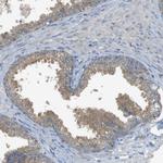 ZDHHC20 Antibody in Immunohistochemistry (Paraffin) (IHC (P))