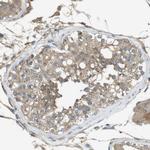 ZDHHC20 Antibody in Immunohistochemistry (Paraffin) (IHC (P))