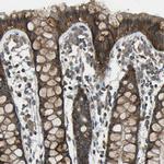 CMTM4 Antibody in Immunohistochemistry (Paraffin) (IHC (P))