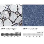 CMTM4 Antibody in Immunohistochemistry (IHC)