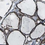 CMTM4 Antibody in Immunohistochemistry (IHC)