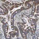 CALHM2 Antibody in Immunohistochemistry (Paraffin) (IHC (P))