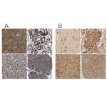 TMEM192 Antibody in Immunohistochemistry (IHC)