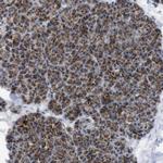TMEM192 Antibody in Immunohistochemistry (IHC)