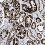 TMEM192 Antibody in Immunohistochemistry (IHC)