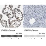 ARL6IP6 Antibody in Immunohistochemistry (IHC)